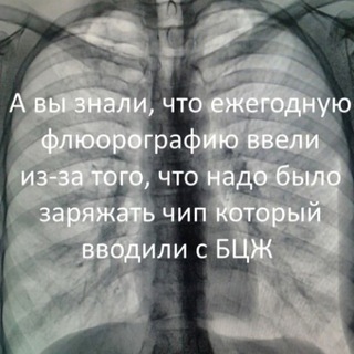 Рентгенология