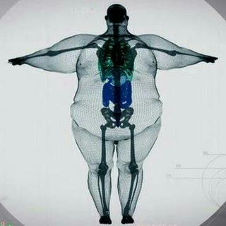 Записки жиробаса