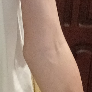 ива дисфория