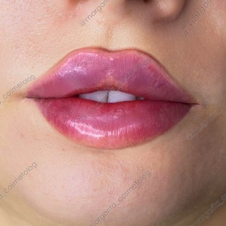 Margarita_cosmetolog