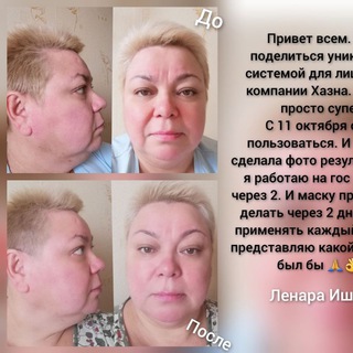 💥РЕЗУЛЬТАТЫ ПО ЛИФТИНГ-СИСТЕМЕ 