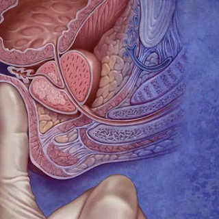 Массаж простаты