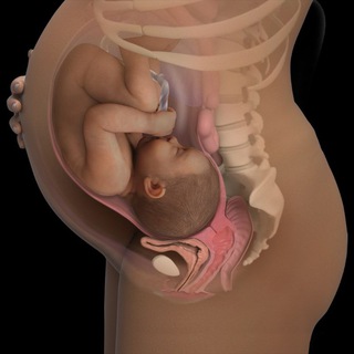 Акушерство и Гинекология