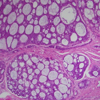 Патология слизистой рта