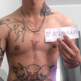 че по шрамам