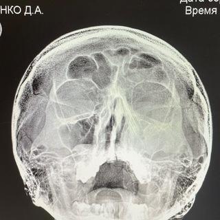 Я и моя шиза