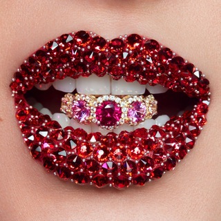 Виниры в рассрочку