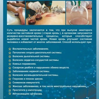 Хиджама - лучшее лечение🪬