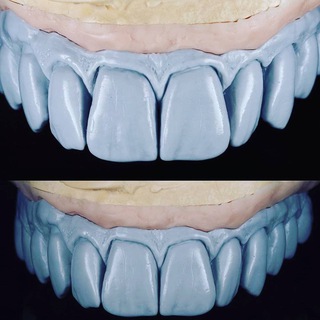 ЗУБНЫЕ ТЕХНИКИ 🇷🇺