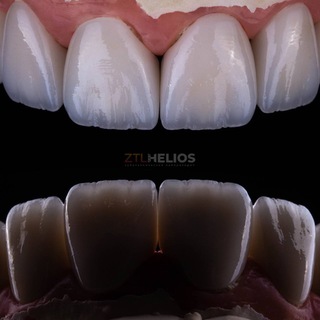 Аналоги зуботехнических материалов Chat