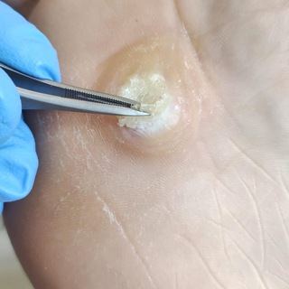 Чат ПОДОЛОГОВ И СПЕЦИАЛИСТОВ ПЕДИКЮРА