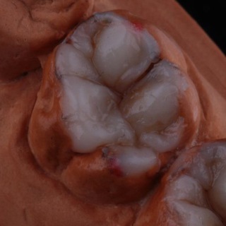 Курс моделирования зубов для стоматологов