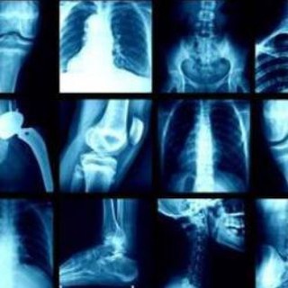 Лучевая диагностика