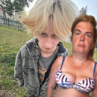 типичный больной от спида