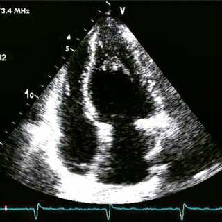 Эхокардиография/Кардиология/Echocardiography/Cardiology🫀👨‍⚕